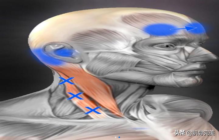 胸锁乳突肌和斜角肌手法松解详解,胸锁乳突肌的运动解剖解析