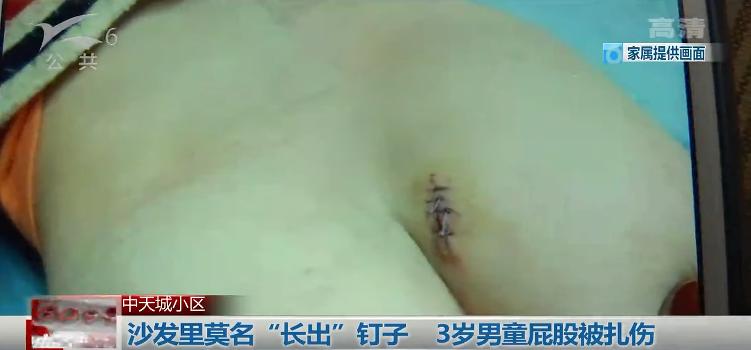 心疼！沙发里莫名“长出”钉子，3岁男童屁股被刮出好长一个口子