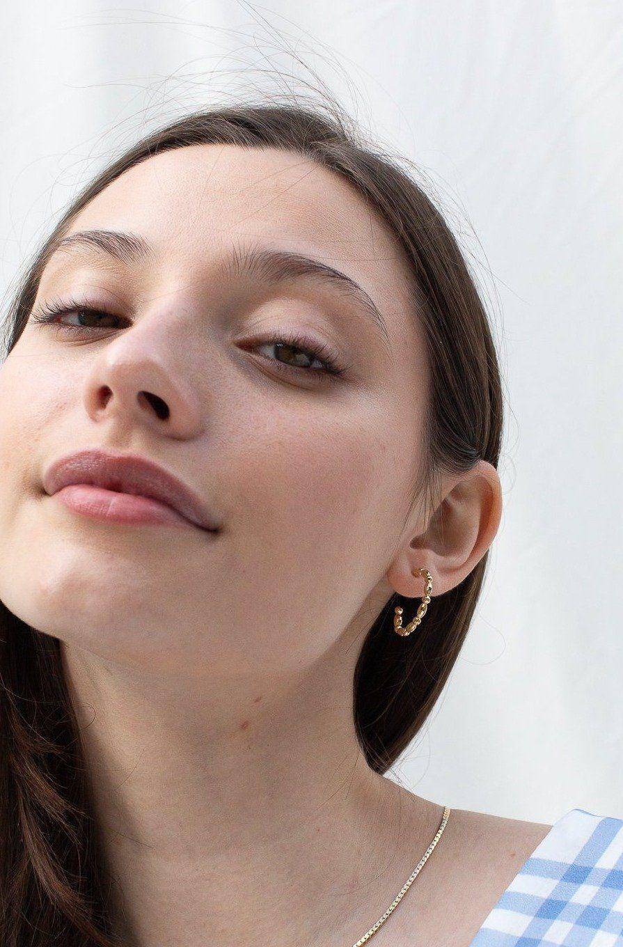 如何有效改善眼周水肿,眼水肿了怎么消肿