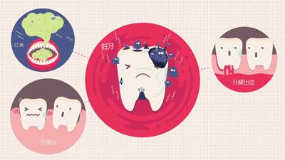 牙菌斑显色剂是在哪里买啊,正畸可以用牙菌斑显色剂吗