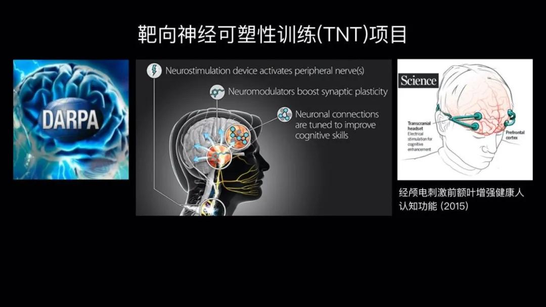 五个能控制你大脑的可怕实验,电击治疗精神分裂症会失忆吗