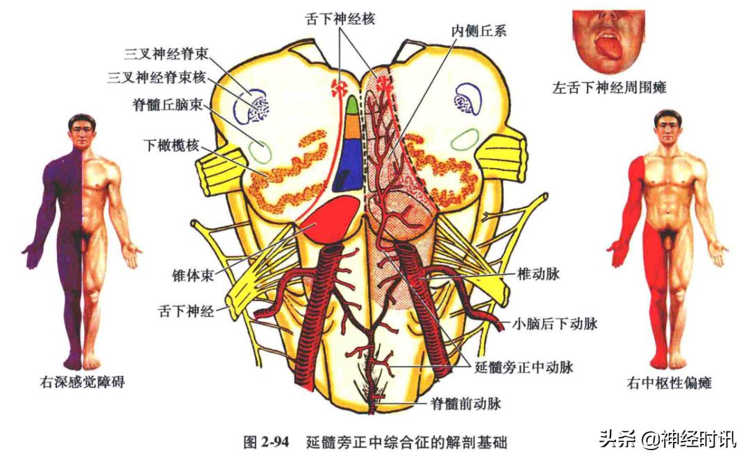 脑干解剖,脑干神经解剖