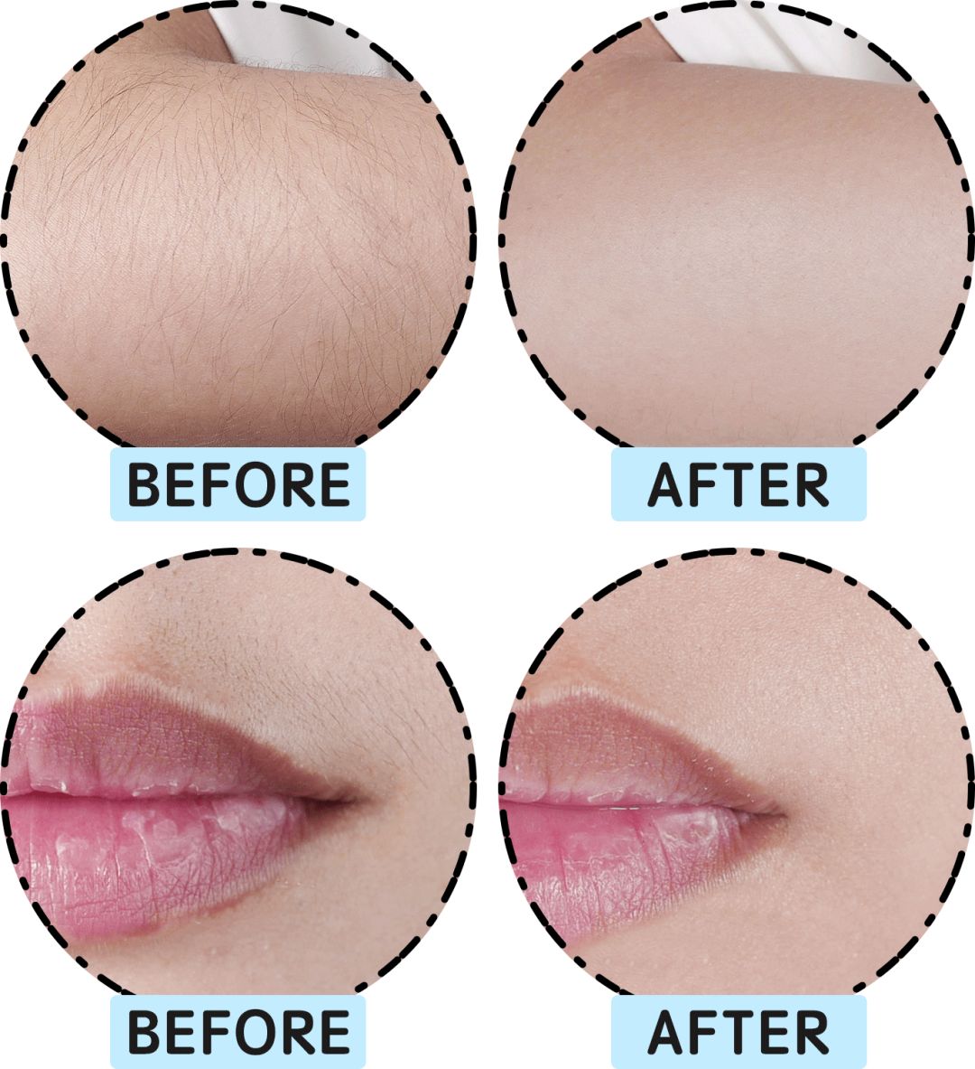 评测市面热销脱毛仪,jovs兰博基尼脱毛仪和ulike哪个好