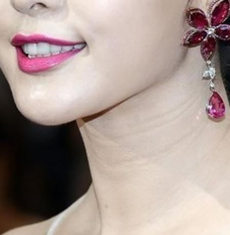 颈纹很深的如何淡化颈纹,颈纹很深怎么办如何淡化颈纹