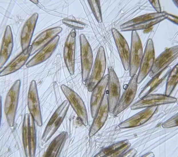 水产养殖藻类老化是怎样的,水产养殖显微镜下各种藻类