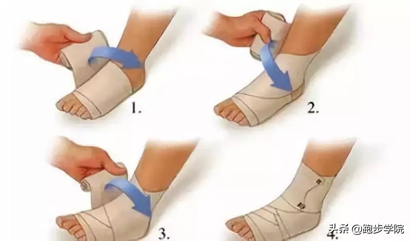 脚踝扭伤的药有哪些,脚踝扭伤了需要吃点什么