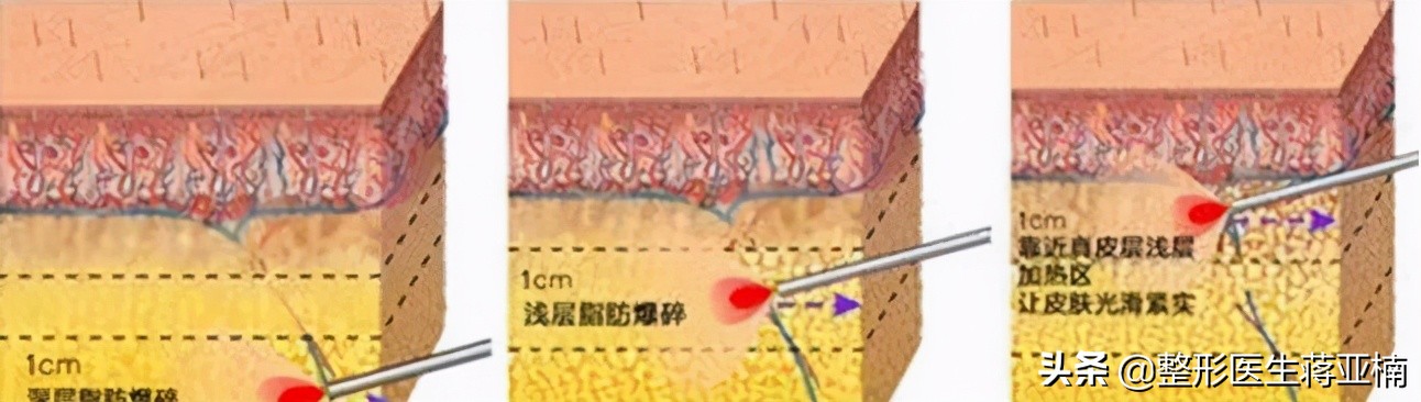 一次性说清,一次性说清一维到十维