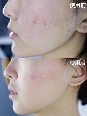 超好用的一款芦荟胶,排名第一的纯天然的芦荟胶