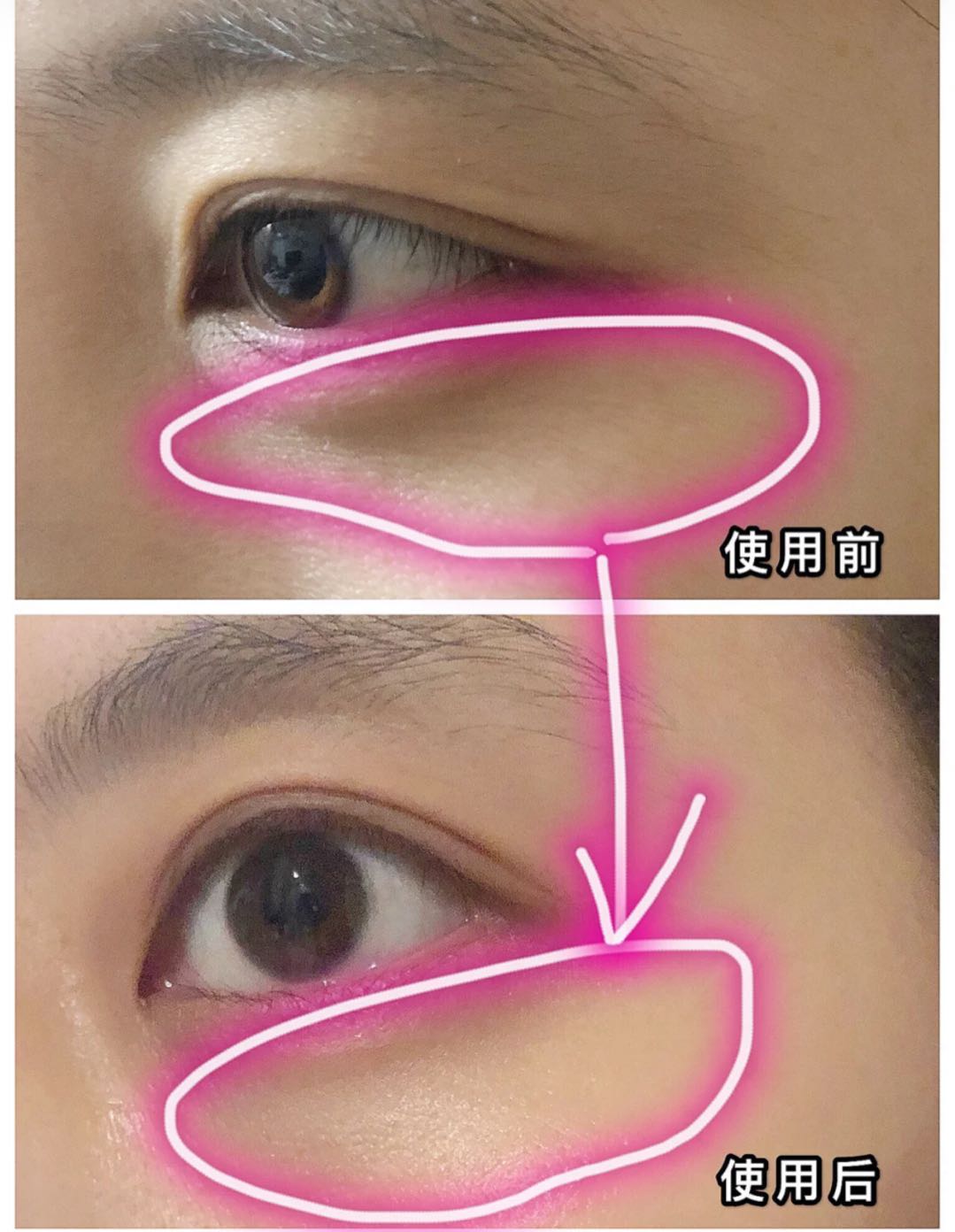 妻子种睫毛后变成面瘫，丈夫想离婚，妻子还沾沾自喜