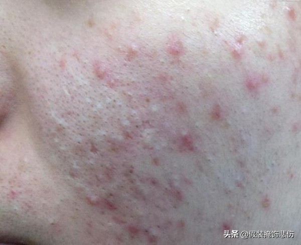 上海硫磺皂哪一款好用,什么品牌硫磺皂正宗又好用