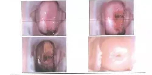 专坑女人的治疗，还在祸害中国女性