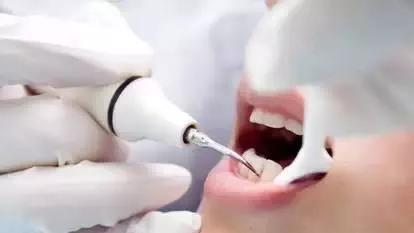 牙不疼不痒有必要定期看牙医吗,牙不疼可以检查出口腔病吗