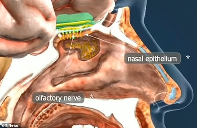 美国男子摔倒,美国男子摔倒昏迷