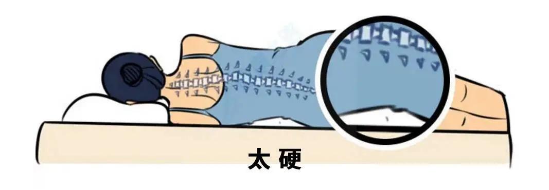 腰不好的人睡哪种床垫比较舒服,腰不好睡硬板床有什么标准