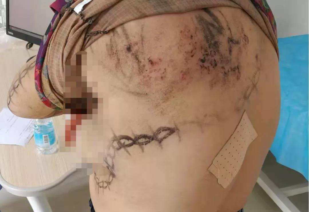 大妈被蛇咬到手里捏着蛇,大妈被蛇缠腰画画