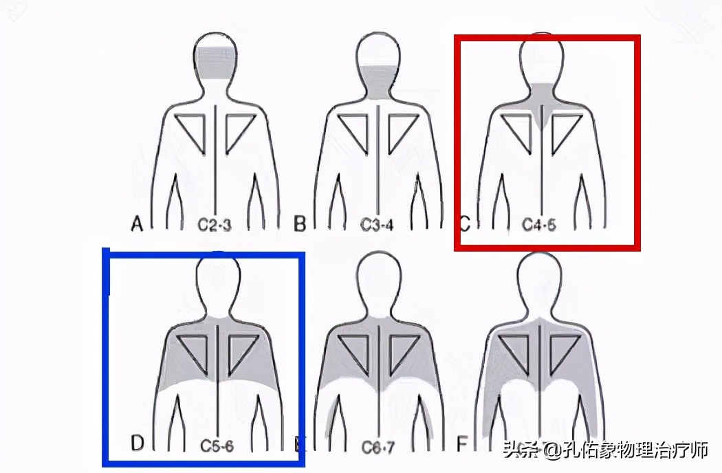 肩周炎肩膀疼痛用什么药,肩膀疼是肩周炎吗还是其他原因