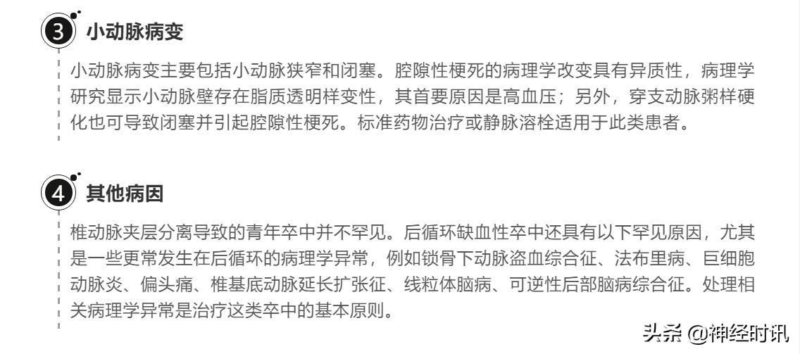 后循环缺血性卒中,后循环缺血性卒中眩晕