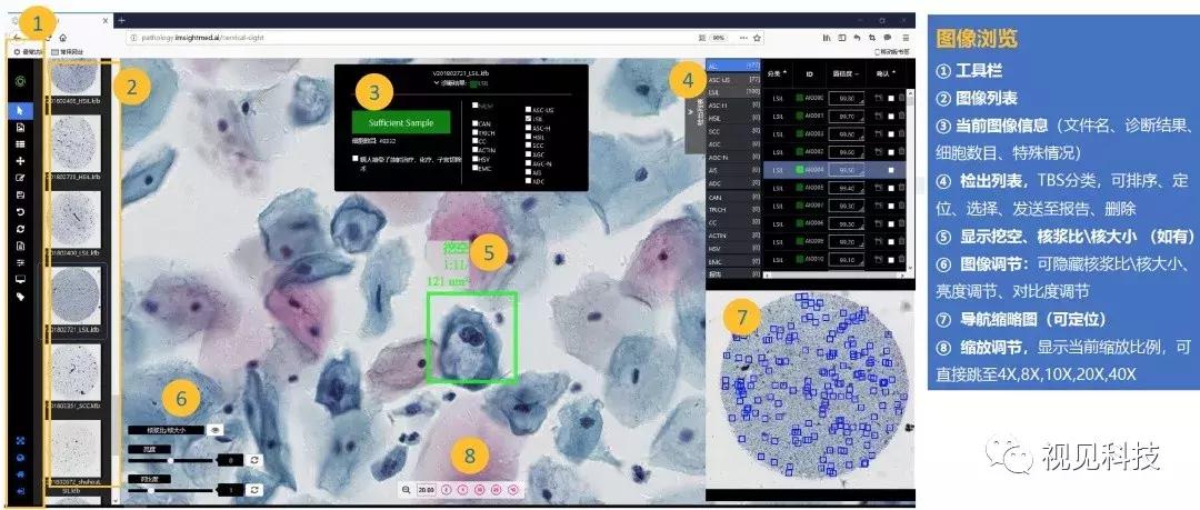 ai鐥呯悊璇婃柇,ai杈呭姪鐥呯悊璇婃柇
