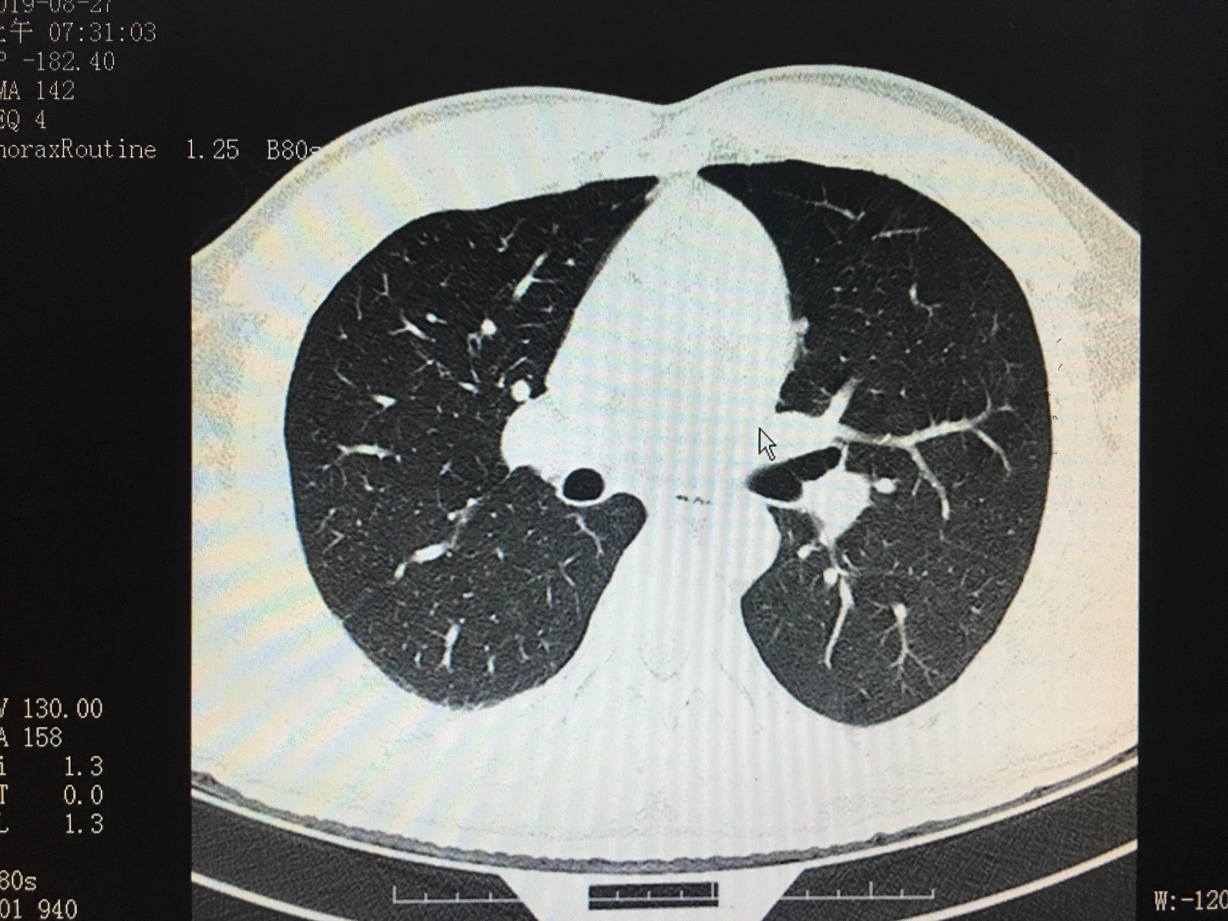 医生说的检查项目我们都必须做吗,医生告诉你应该做哪些检查