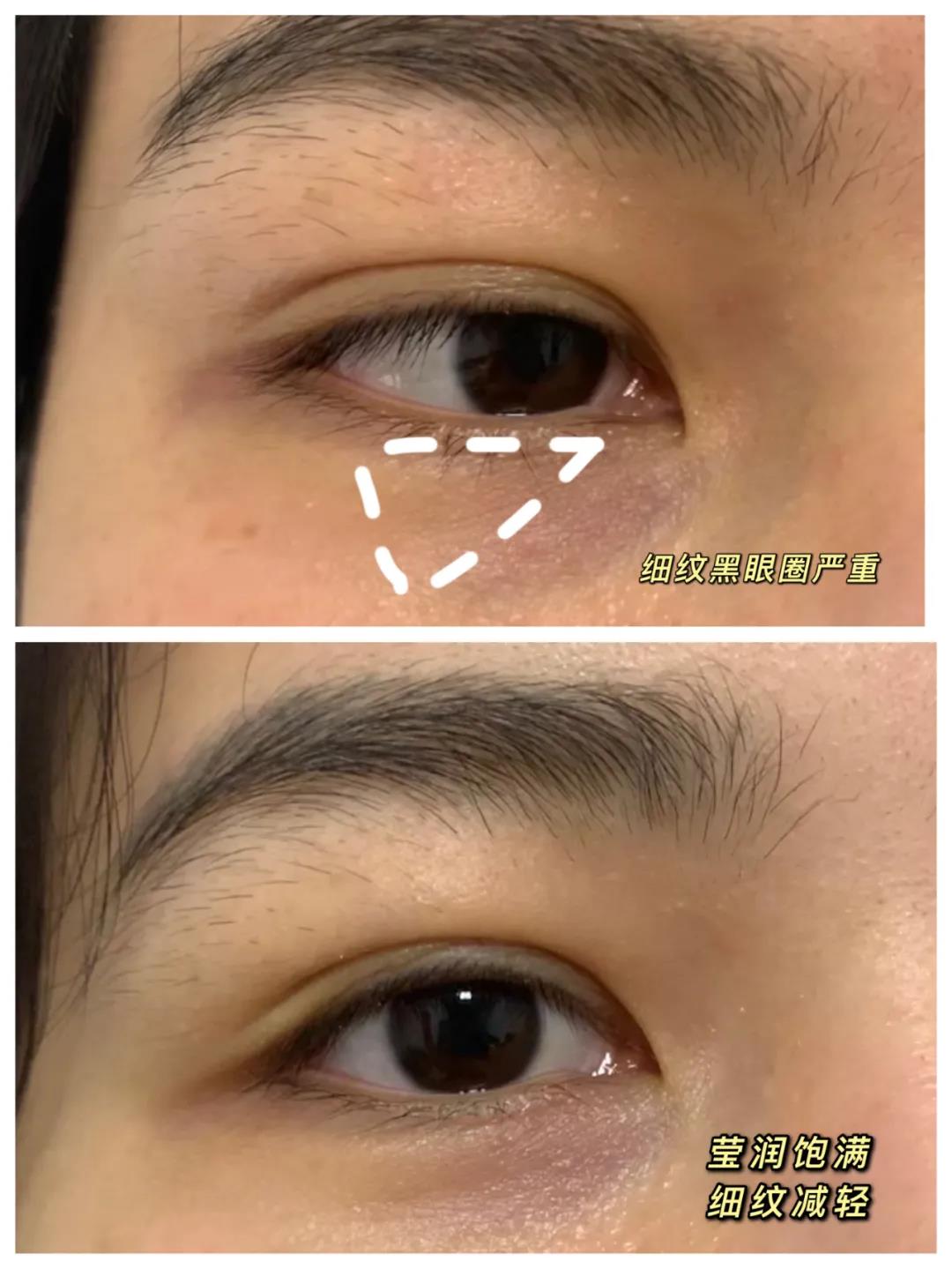 脸上出现干纹细纹化妆怎么拯救,脸部化妆起皮卡粉咋办