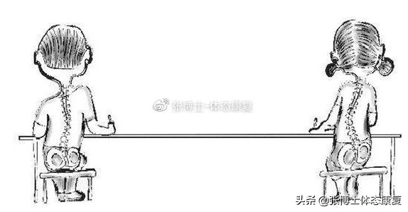 如何让青少年体态矫正,体态问题很严重去哪里矫正