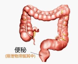 几天没有排便才是便秘吗,排毒清肠辟谣