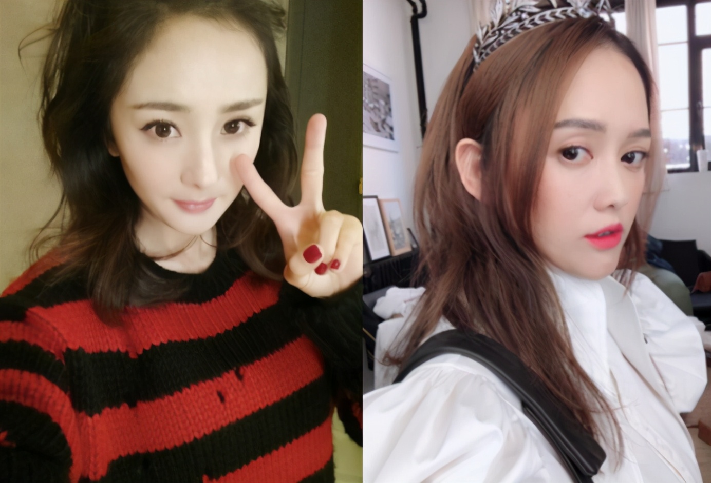 发际线掉发是什么原因造成的女性,发际线后移脱发的原因和治疗方法