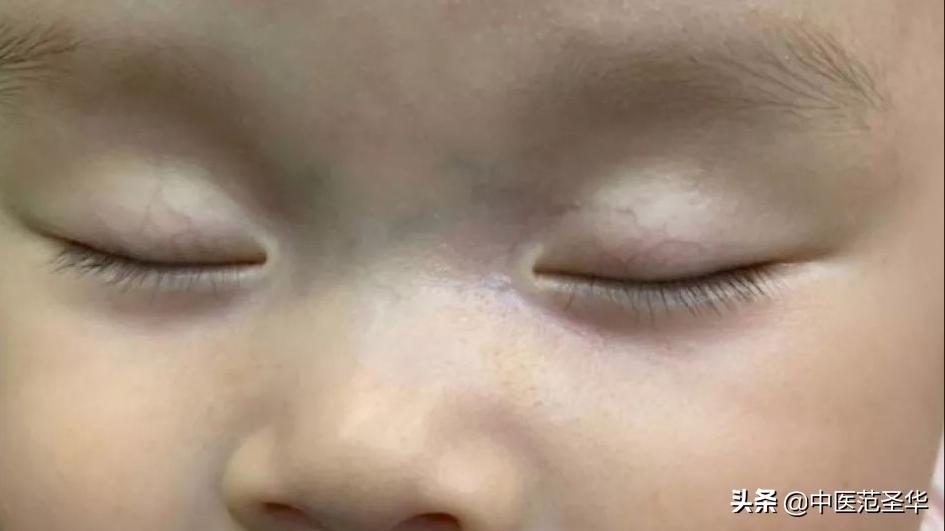 小孩山根青色是什么原因,孩子山根发青面相