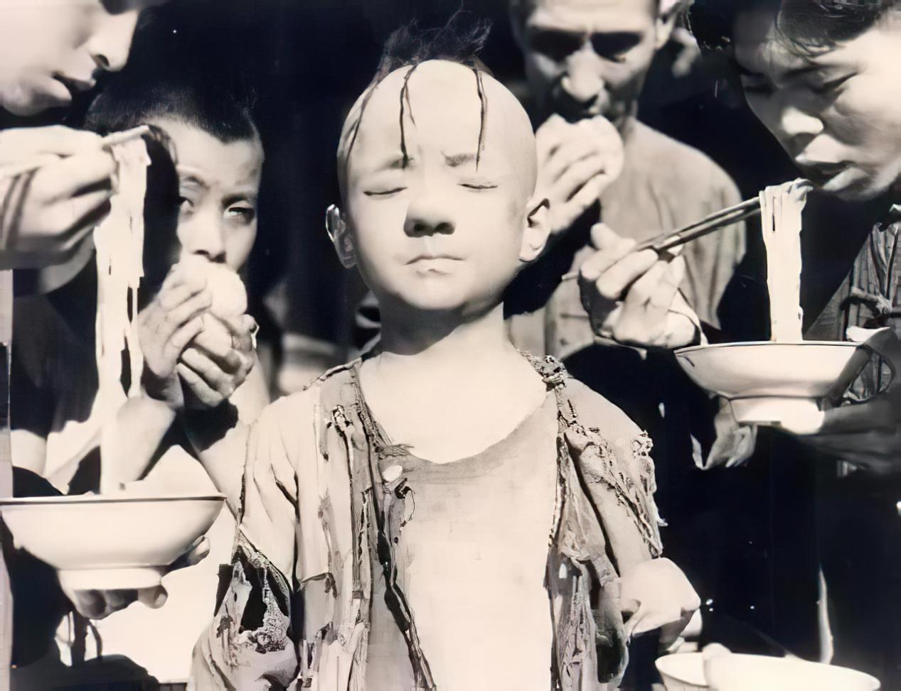 “三毛”34岁了！8岁爆火，14岁谢顶，植发挨300多针，如今变帅哥