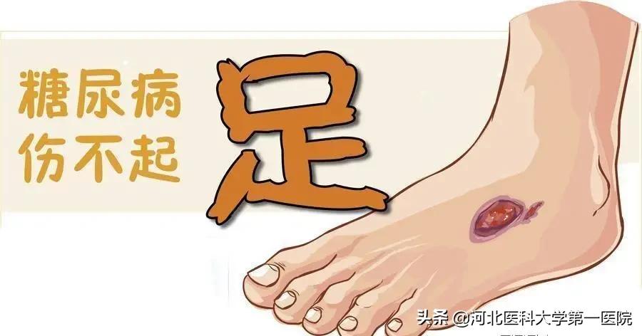 双脚肿是什么病的前兆,双脚肿疼痛是什么原因引起的