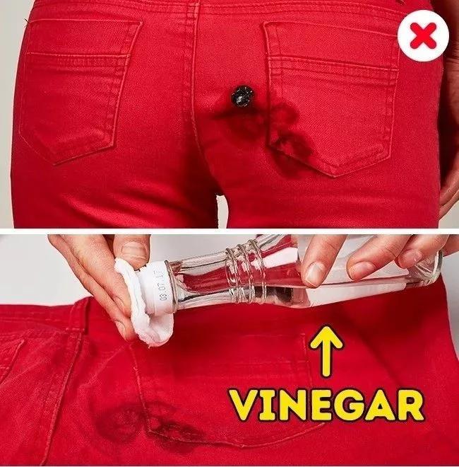 名门泽佳去眼袋红肿结痂图片,名门泽佳去眼袋效果怎么样