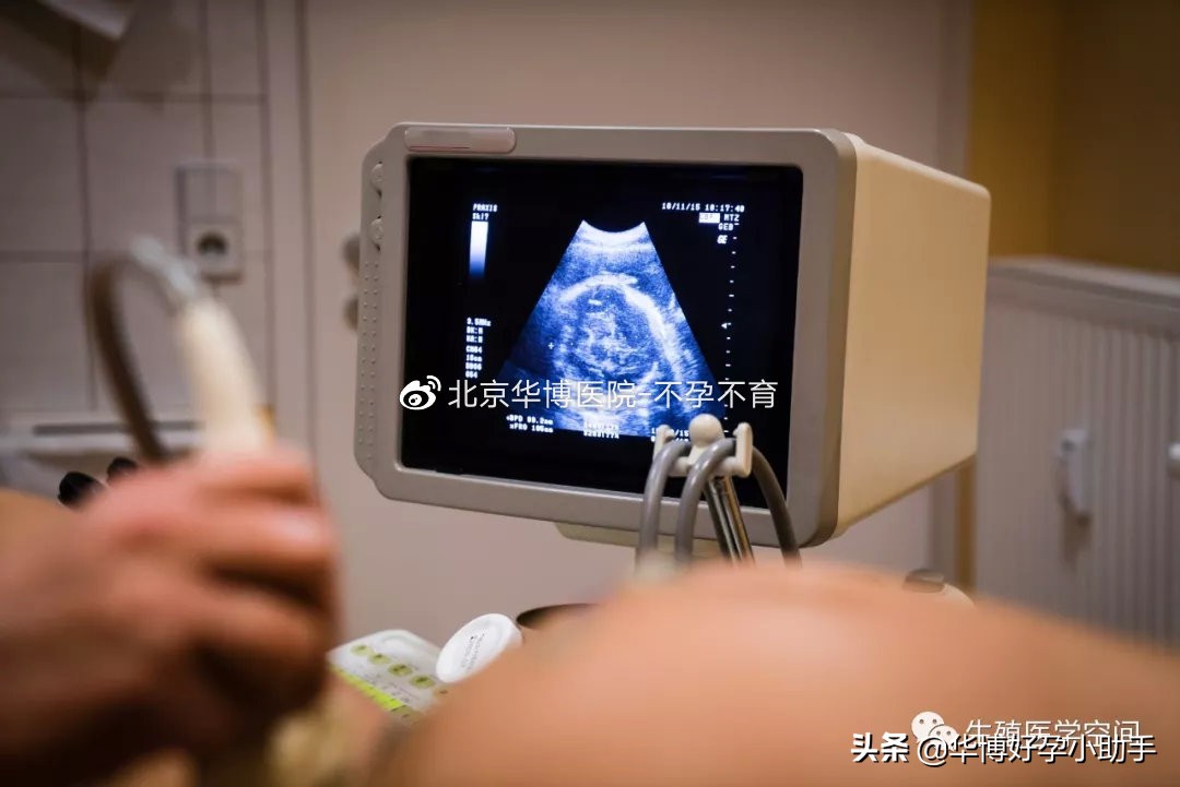 孕期见红，除了流产，还有这3种危险情况