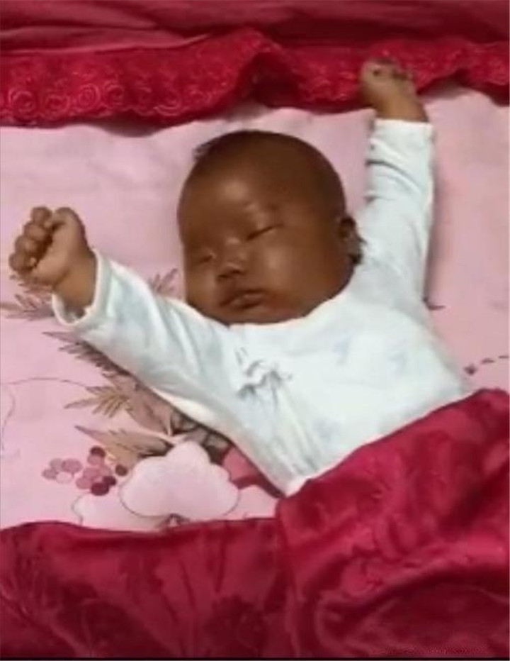 刚出生的宝宝太黑了,新生儿皮肤太黑是什么造成的