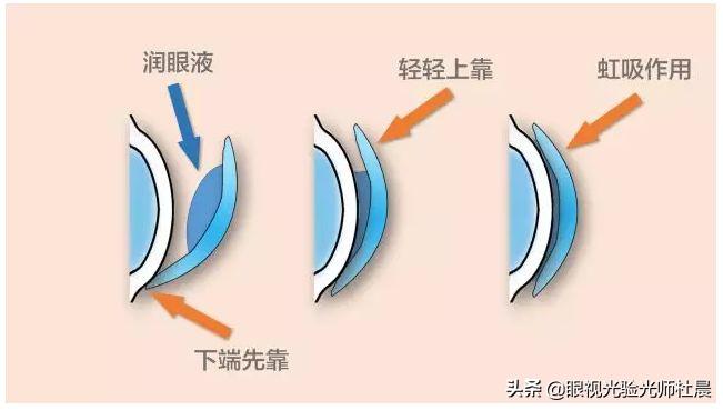 初次戴隐形眼镜的技巧,戴隐形眼镜眼睛注意事项