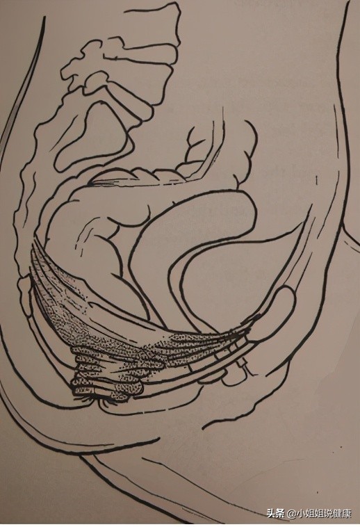 盆底锻炼除了凯格尔还有哪些,凯格尔运动能锻炼盆底深层肌肉吗