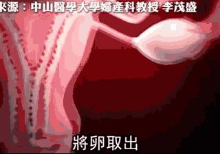 14岁女孩为钱卖卵被切子宫!关于排卵,你不得不知的4件事!