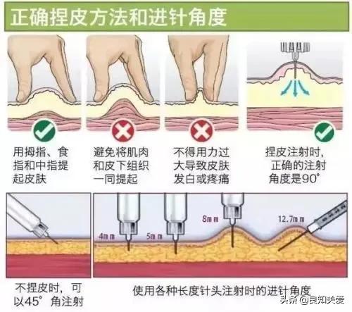 打胰岛素皮肤肿了怎么办,打胰岛素地方硬肿疼是怎么解决