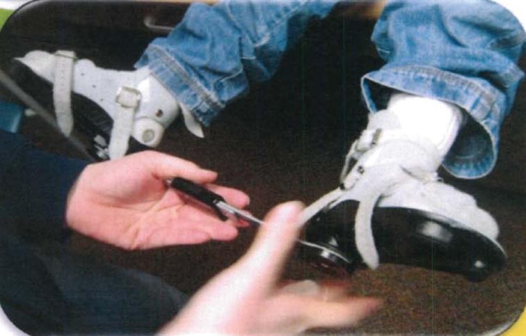 马蹄内翻足的护理有哪些呢,马蹄足内翻矫正支具