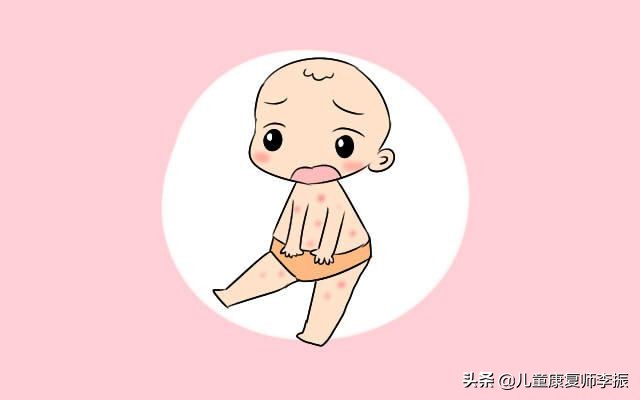 宝宝湿疹饮食禁忌食谱,宝宝起湿疹妈妈饮食需要注意什么