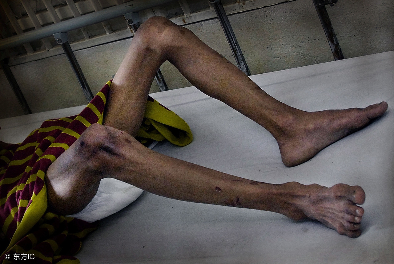 关于艾滋病你需要知道这10件事,关于艾滋病你需要知道这三点