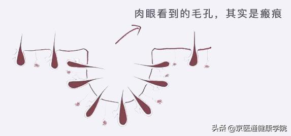 脸色发黄毛孔粗大出油严重怎么办,脸部爱出油长痘毛孔粗大怎么调理