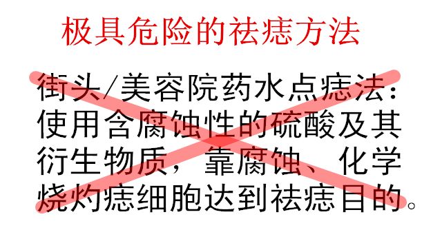 中医院点痣方法,中医治疗点痣