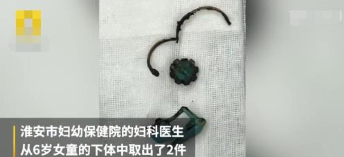 五岁女童吸入异物在气管里,幼儿园女童被塞异物后续