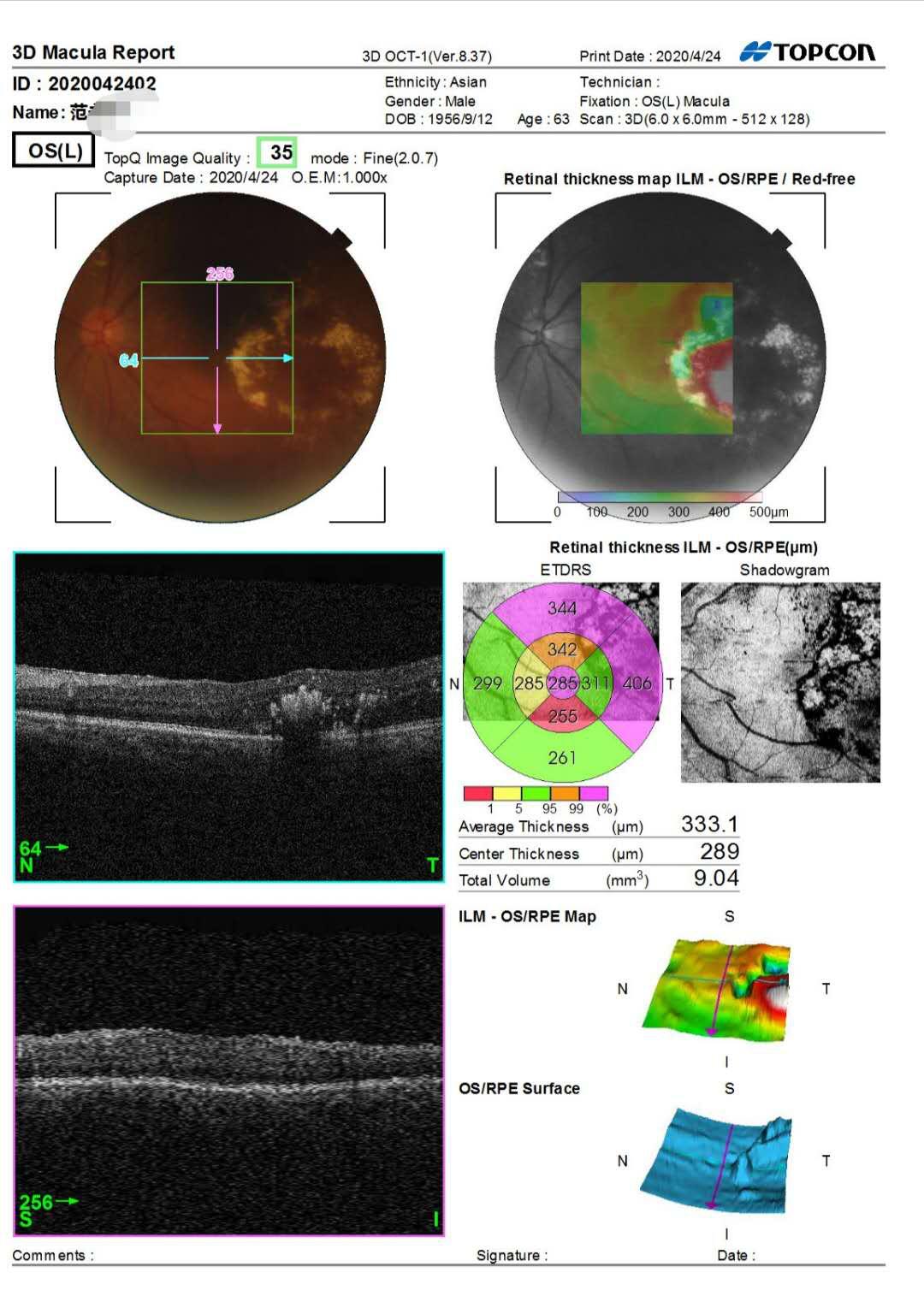 眼科先天性眼底病变,眼底病变医院