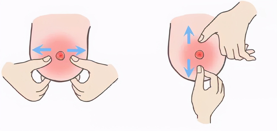 捂脸！乳头像火山口般凹陷，会影响哺乳功能吗