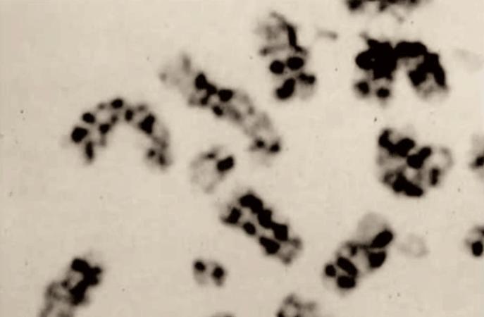 83天核事故救治纪录片,核灾83天死亡全记录