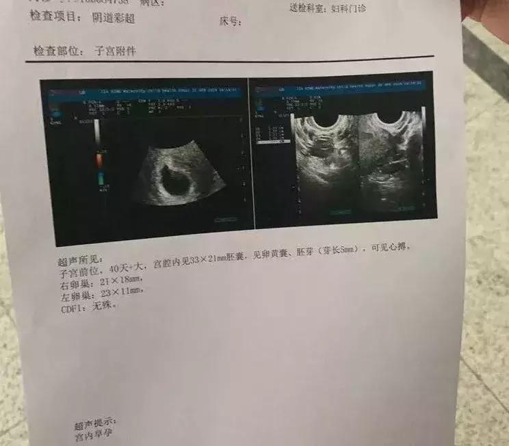 月经干净第1天同房，女朋友肚子里的孩子是不是他的？