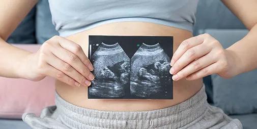 产检b超大排畸,产检b超数据股骨长