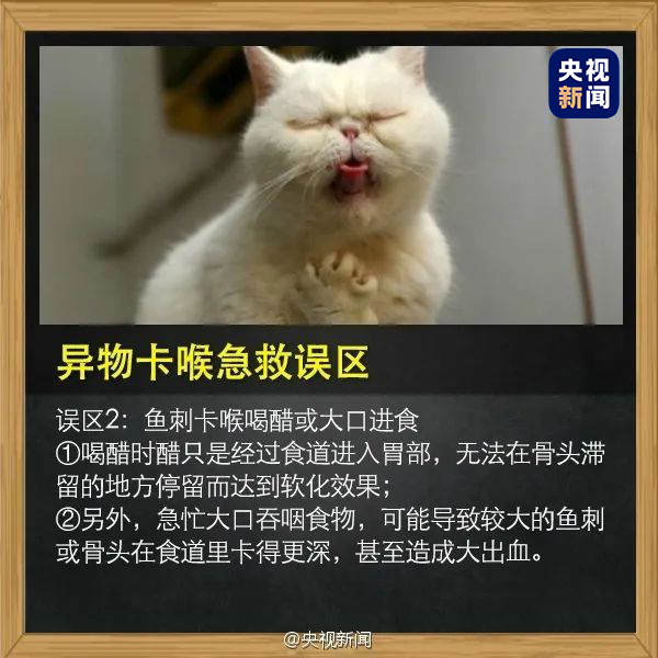 儿童异物卡喉梗阻窒息急救法,孩子被异物卡喉怎么做手术