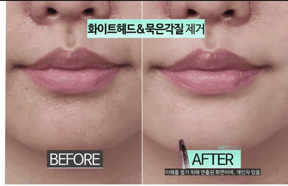 去黑头去角质慕斯,3分钟祛除黑头